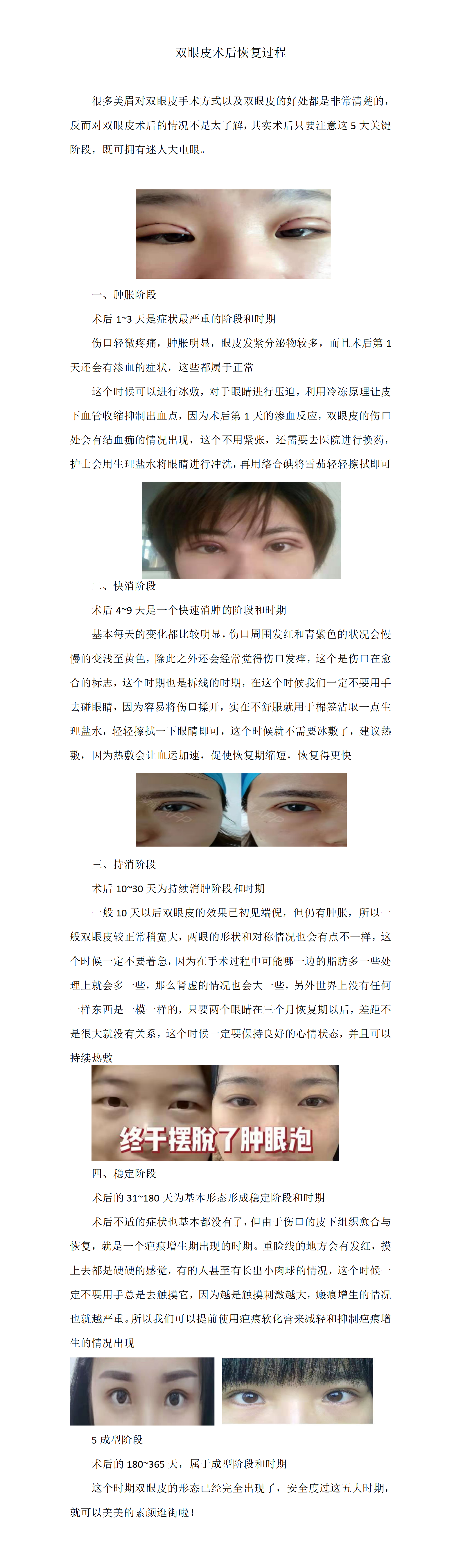 手术室科普双眼皮术后解读(1)_01.png