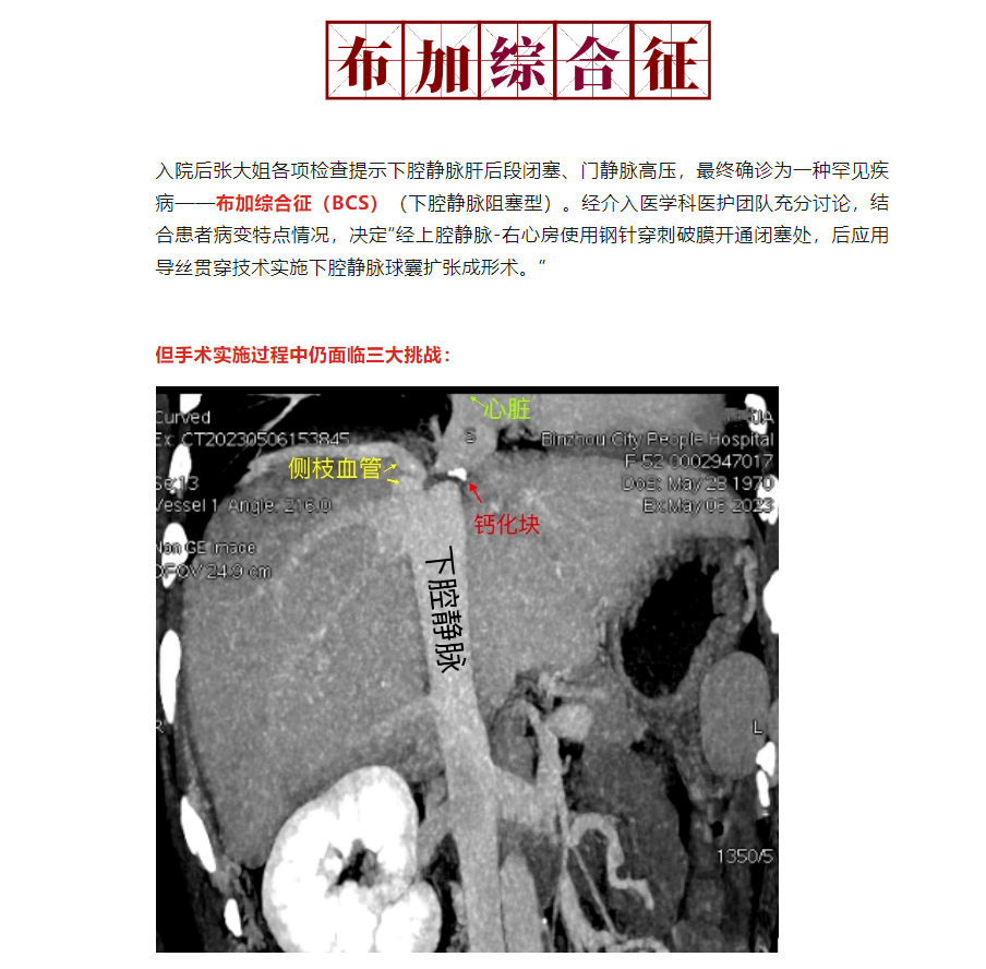 7abfa966f4d0c3697dbb5ebf293b776.png
