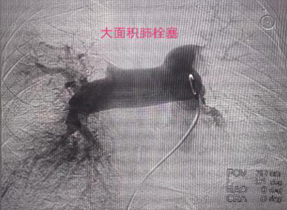 图片11.png 图片11.png