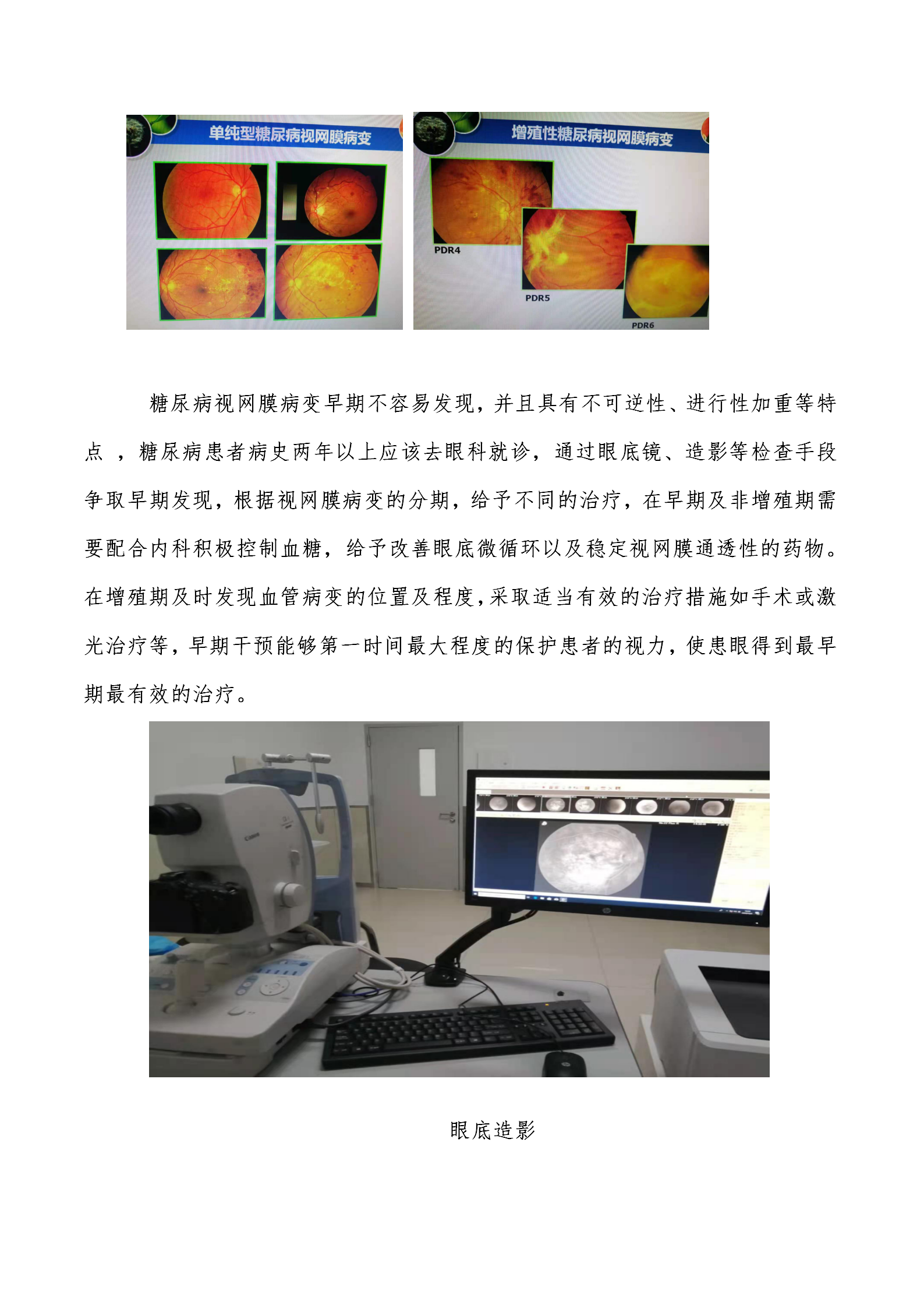 糖尿病视网膜病变科普_02.png