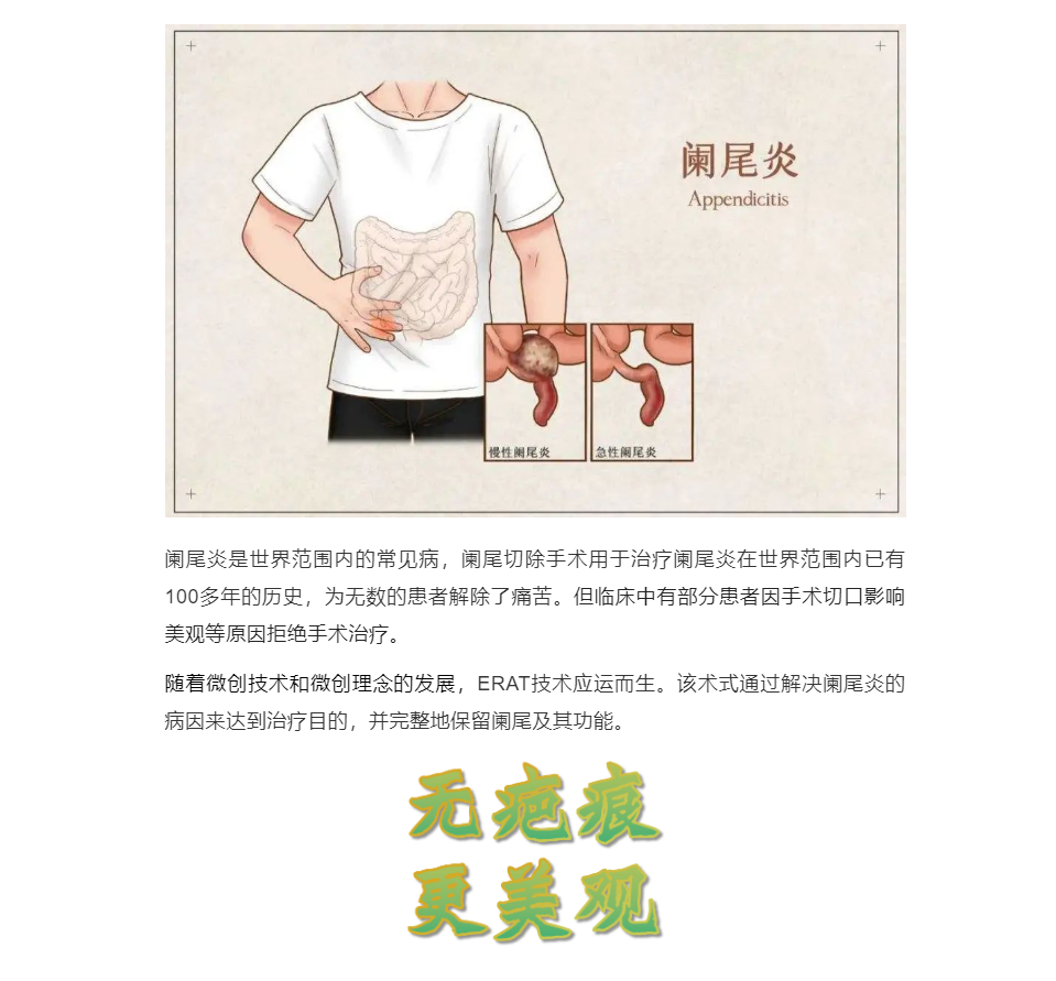 983fd8057c153bc237f3381839744ac.png
