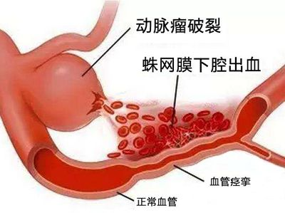 图片5.png 图片5.png