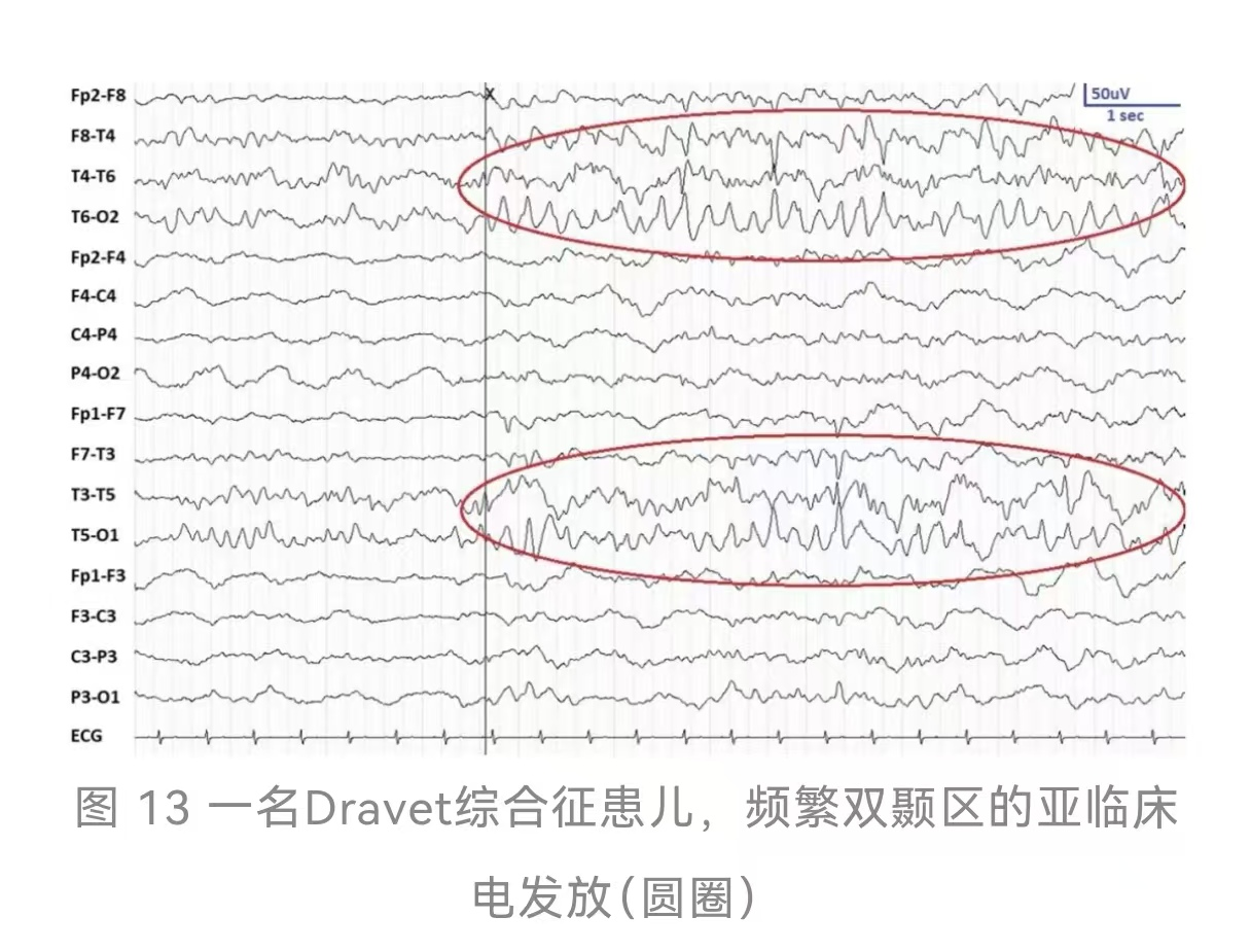 图片 1.png 图片 1.png